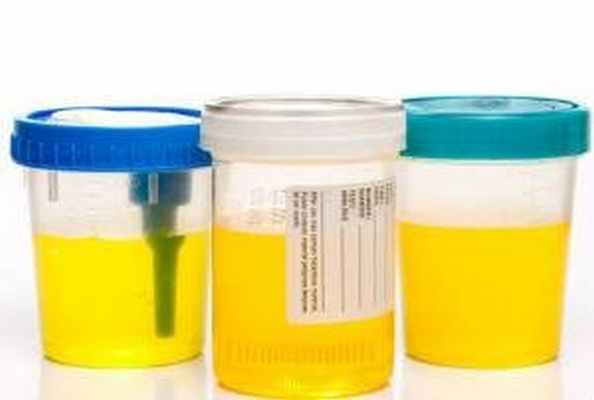 банночки с анализом мочи фото