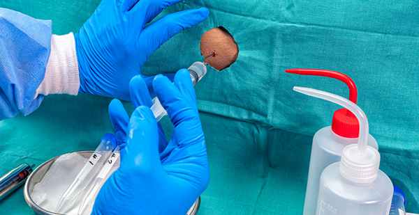 Диагностика поперечного миелита