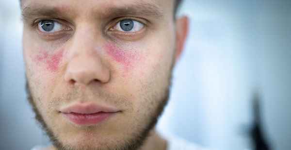 Связанные с поперечным миелитом состояния