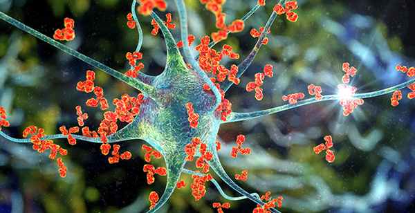 Причины и развитие поперечного миелита