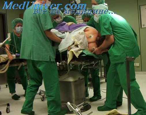 отогенный синустромбоз