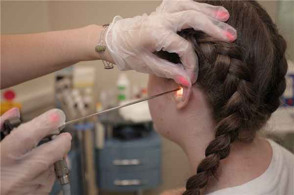 Грибковый наружный отит (отомикоз, грибок в ушах)