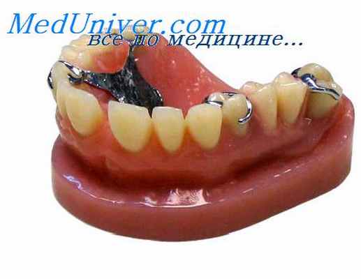 беззубая челюсть