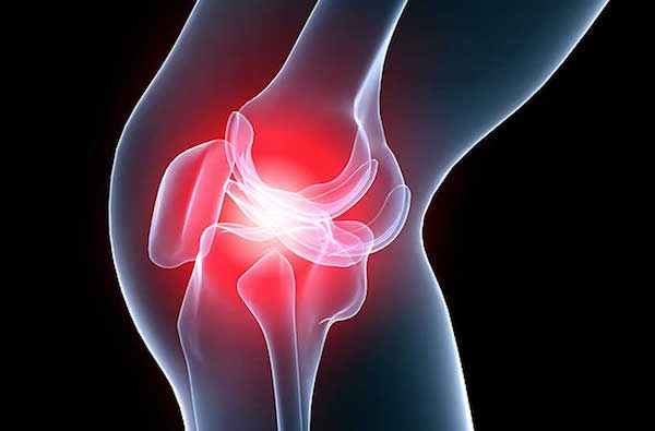 Боль в колене