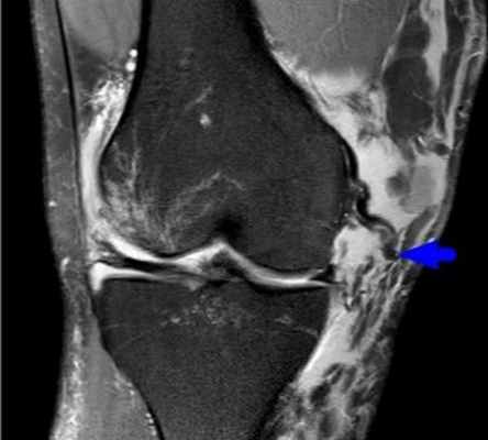 Боль в области колена