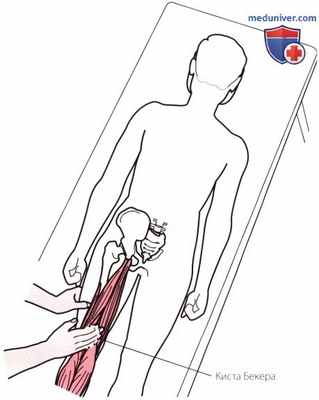 Пальпация коленного сустава сзади