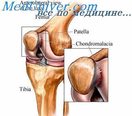 связки коленного сустава
