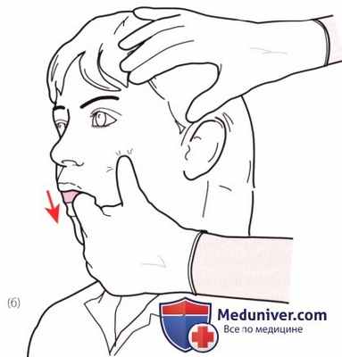 Пальпация височно-нижнечелюстного сустава спереди