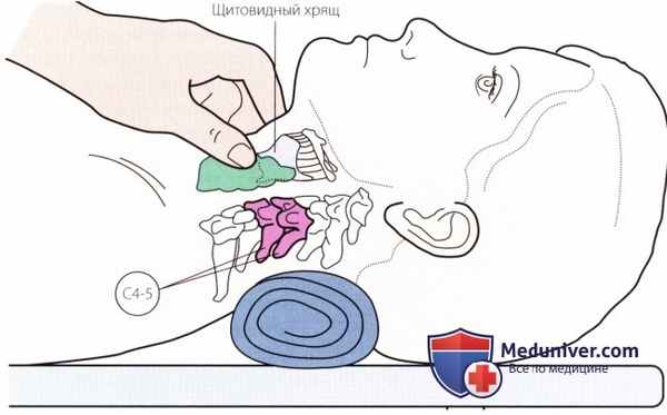 Пальпация костей, хрящей шеи и грудной клетки спереди