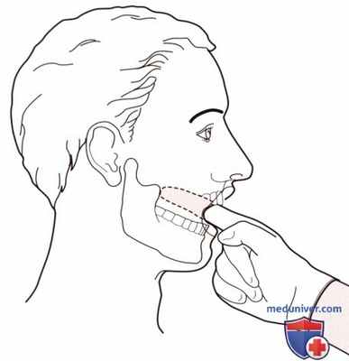 Пальпация височно-нижнечелюстного сустава спереди
