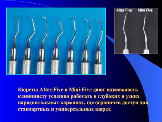 Кюреты After-Five и Mini-Five дают возможность клиницисту успешно работать в глубоких и узких пародонтальных карманах, где ограничен