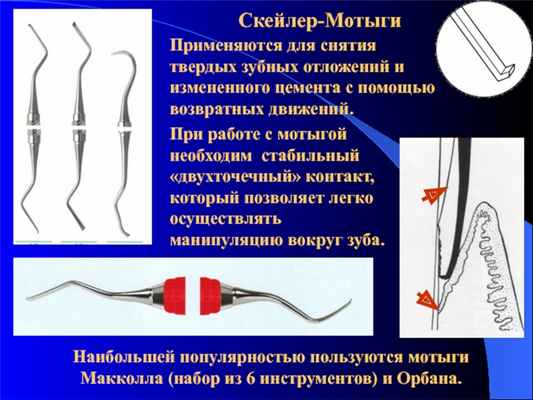 Скейлер-МотыгиПрименяются для снятия твердых зубных отложений и измененного цемента с помощью возвратных движений.При работе с мотыгой необходим