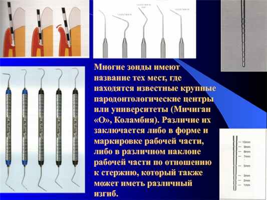 Многие зонды имеют название тех мест, где находятся известные крупные пародонтологические центры или университеты (Мичиган «О», Коламбия).