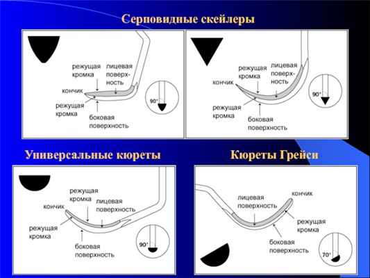 Универсальные кюретыКюреты ГрейсиСерповидные скейлеры