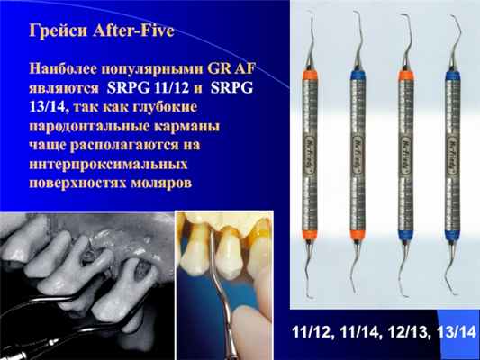 Грейси After-Five11/12, 11/14, 12/13, 13/14Наиболее популярными GR AF являются SRPG 11/12 и SRPG 13/14, так как глубокие