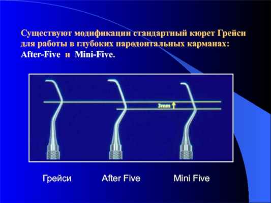 ГрейсиAfter FiveMini FiveСуществуют модификации стандартный кюрет Грейси для работы в глубоких пародонтальных карманах: After-Five и Mini-Five.