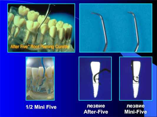 лезвие After-Fiveлезвие Mini-Five1/2 Mini Five