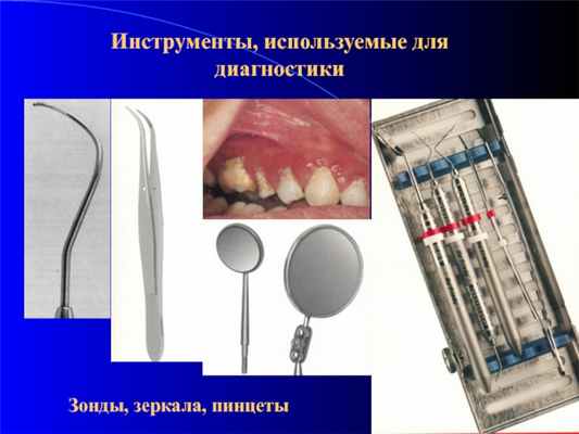Инструменты, используемые для диагностикиЗонды, зеркала, пинцеты