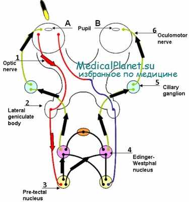 мононеврит глазодвигательных нервов у детей