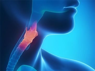 Парез голосовых связок