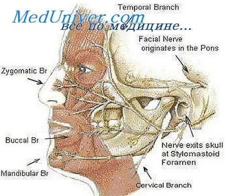 паралич лицевого нерва