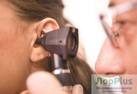 Парацентез (прокол) при экссудативном отите