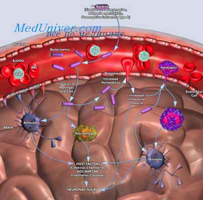 развитие менингита