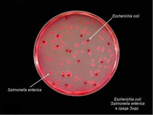 Бактерии в агаре Эндо