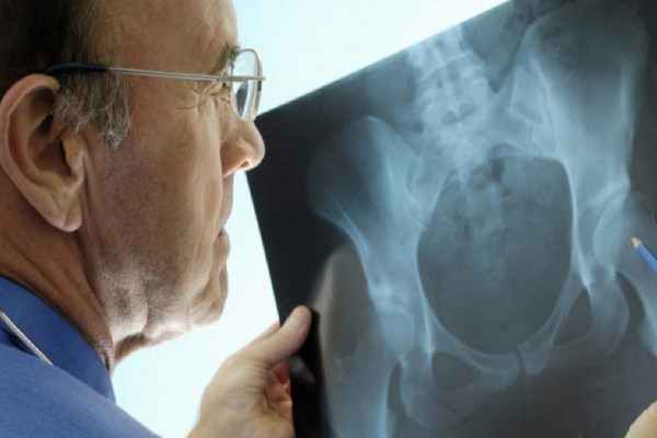 Ложный сустав