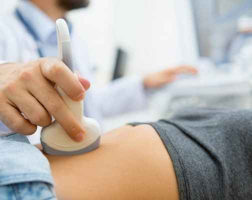 Киста яичника