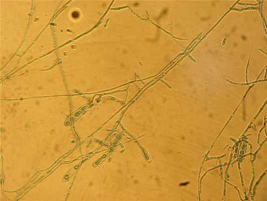 Препарат Epidermophyton floccosum