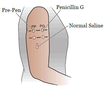 Рисунок 4. Метки внутрикожной пробы
