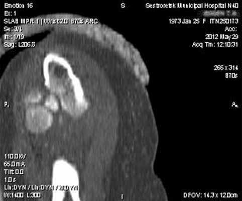 Рис. 2. КТ-исследование