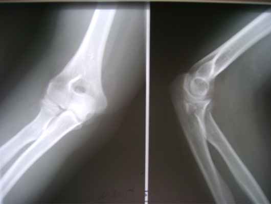 Рис. 1. Рентгенологическое обследование