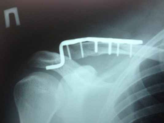 После операции