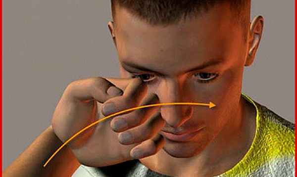 Фото Перелом носа со смещением