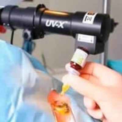 Операция по кросс-ликингу роговицы - Центра глазной хирургии по лечению глаз, коррекции и восстановлению зрения при помощи лазера.