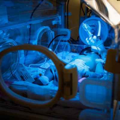 реанимация новорожденных (1)