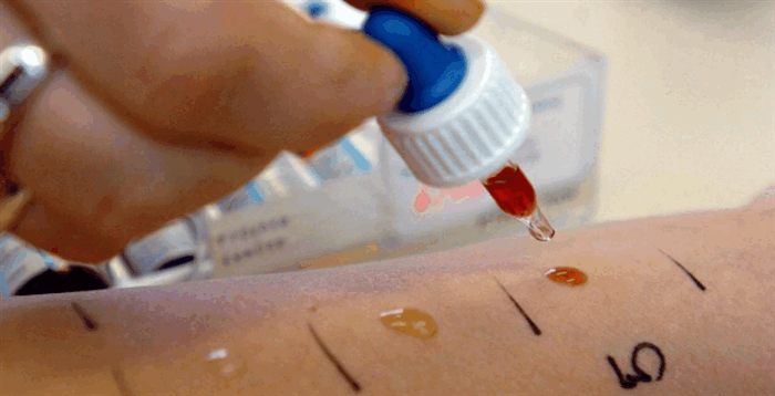 perioralnyj-dermatit2