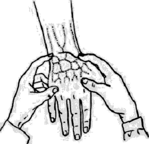 Пальпация лучезапястного сустава