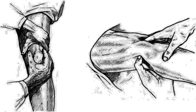 Пальпация коленного сустава