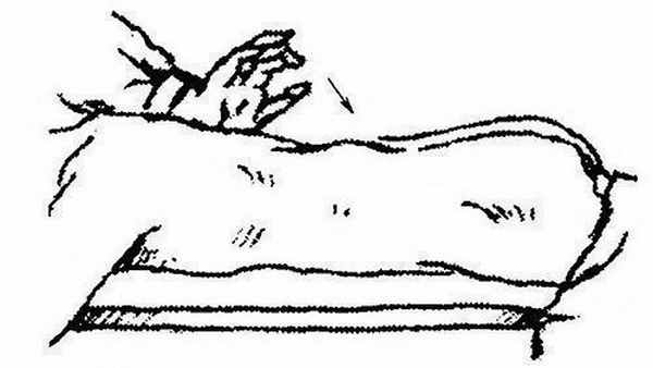 Перкуссия остистых отростков позвоночника