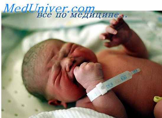 легочная гипертензия у ребенка