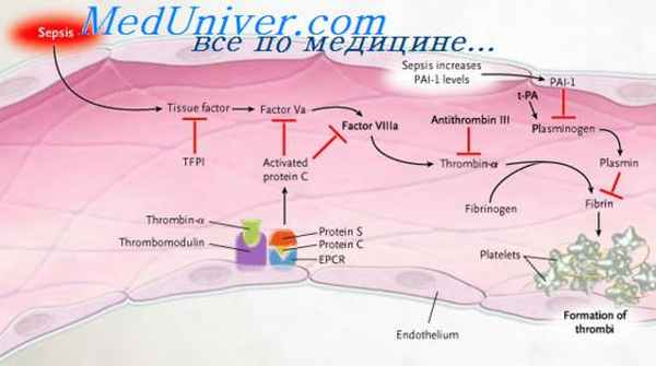 гнойная инфекция