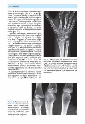 Рис. 1.4. Мужчина 40 лет. Нарушение функции вследствие длительной иммобилизации