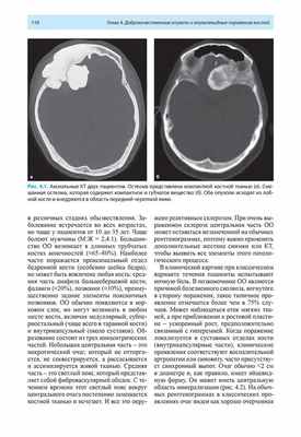 Рис. 4.1. Аксиальные КТ двух пациентов