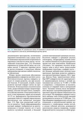 Рис. 2.4. Талассемия. КТ, аксиальные срезы.