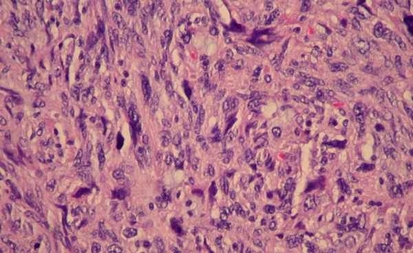 Курсы по патологической анатомии