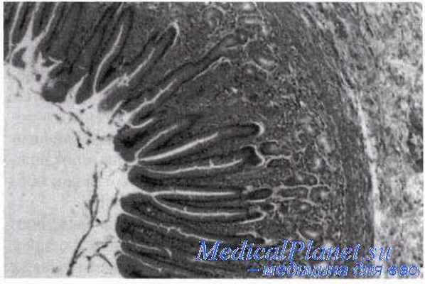 Пищевод. Перистальтика. Желудок.