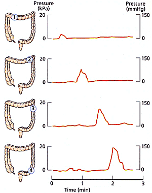 Изменение давления в разных точках толстой кишки при прохождении по ней перистальтической волны